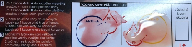 pp1